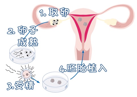 供卵成功率